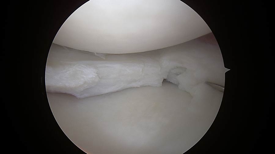 Ortopedico Ginocchio Firenze